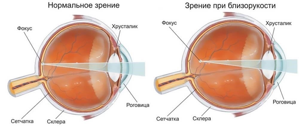 1. Зрение и слух: Способность хорошо видеть и слышать является основным критерием. Любое значительное нарушение в этих областях может привести к снижению оценки пригодности.