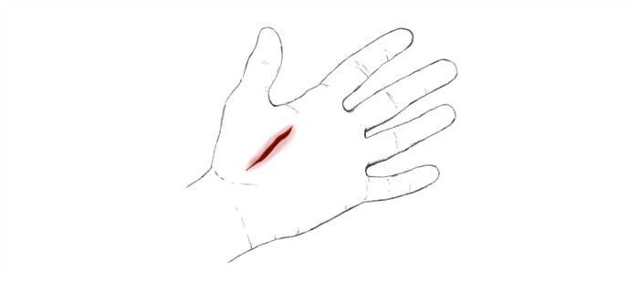 Какими средствами обработать рану на запястье?