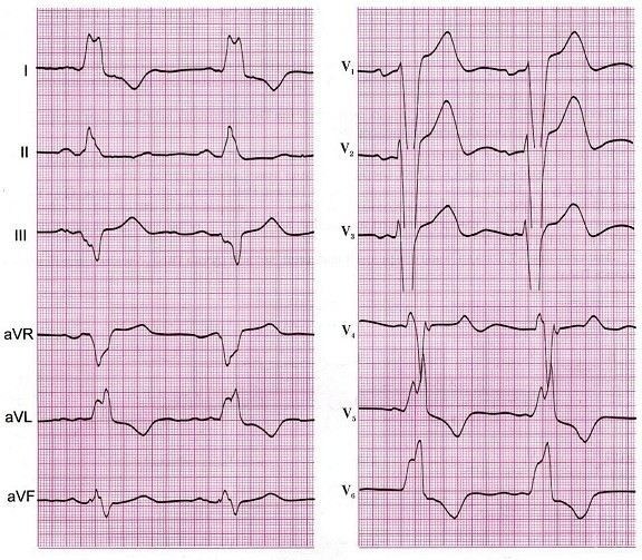 Какова роль медикаментозного лечения?