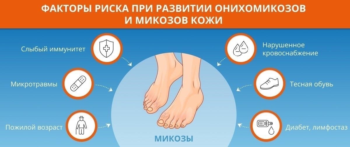 Факторы, повышающие риск развития грибковых инфекций кожи или ногтей