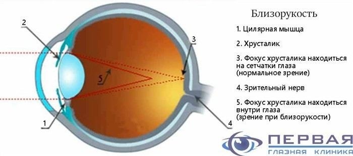 Трудности в условиях плохой видимости
