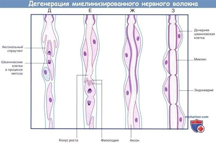Методы восстановления периферического нерва: обзор современных подходов
