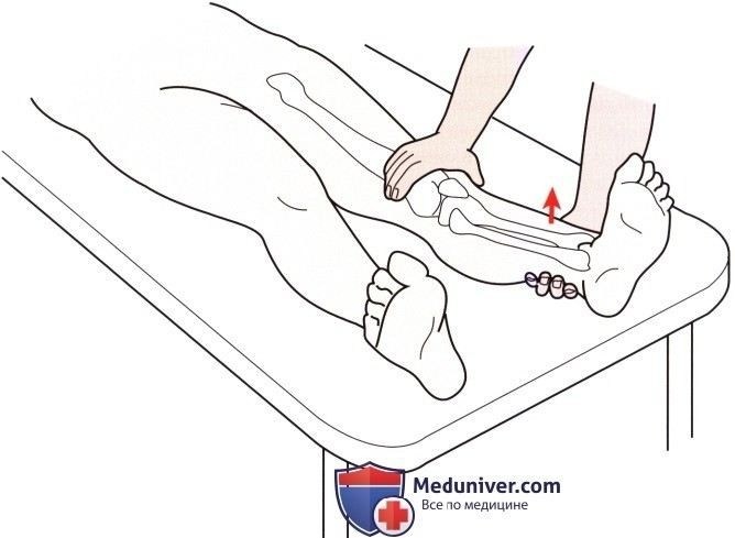 Причины ограниченного объема движений в коленном суставе