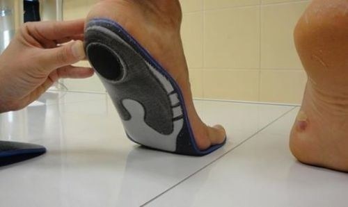 Как плоскостопие влияет на призыв в армию