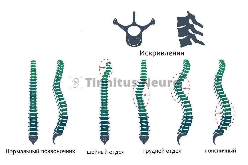 Проблемы оценки нестабильности шейного отдела позвоночника для определения пригодности к военной службе