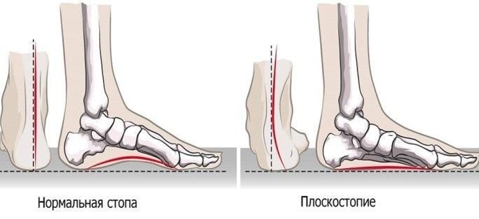 Что делать, если решение призывной комиссии не устраивает?